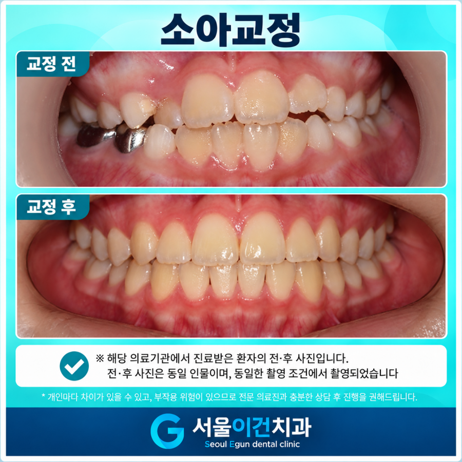 수원교정치과